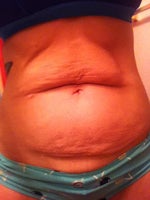 Who is my  before belly twin? 