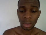 Are there Any Doctors Who Specialize in African American Rhinoplasty?
