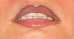 How Can I remove DARK VIOLET from my lips???