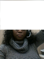 Hello I Am an African American Women and I Have Frown Lines Which Bothers Me