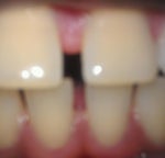 Not Sure About Consultation w/ Ortho, Need Some Input...