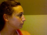 Has anyone gotten rhinoplasty by an ENT doctor who's board certified in plastic surgery?