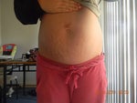 pregnancy after tt