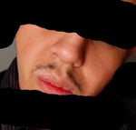 Silicone Injection Removal in Dallas?
