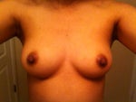 32c or 34b vs bra size, what size of saline implants should i get?