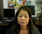 Asian Blepharoplasty Expert in Orange County, CA?