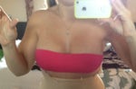 Tummy Tuck 457cc over the muscle post op 9 days 