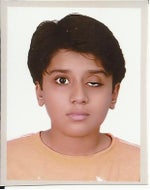 12 Years old with ptosis and Doctor in Toronto