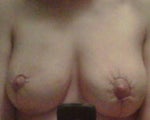 Left nipple smaller than right due to bunching?