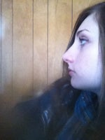 Please give honest feedback--Do I need plastic surgery???