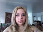 Boxy nose should I get Rhinoplasty?