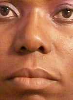  do i have polly beack nose