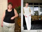 Top Ten Tips Before and After Gastric Bypass Surgery