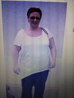 I Have the Lapband in and Wish to Get Pregnant Again, Will This Effect my Weight Gain or Loss? (photo)