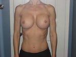 Do my breasts look too big?