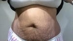 BBL withOUT Tummy Tuck with "after kid" belly.... results???