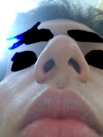 Do I have deviated septum or what is my case?