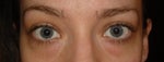 Any experienced Silikon 1000 doctors in the Naperville IL area?
