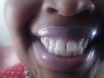 I'm looking for affordable orthodontist in NYC