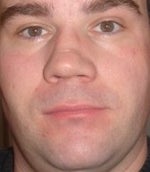 Mixed messages about fixing crooked nose?