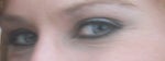 What's the best treatment for eye wrinkles for a woman in her late 20s?