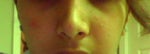 How small will the nose go after the swelling?