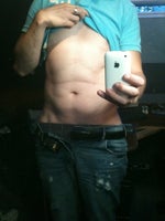 5 weeks since having vaser hi def and no results
