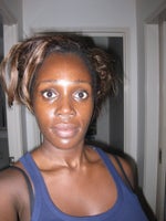 What type of cheek augmentation should I use to get high cheekbones?
