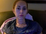 RE: Getting rid of thyroid surgery scar