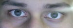 Non-symmetrical eyes