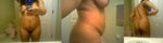 Tummy tuck vs. lipo