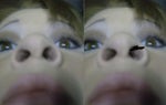 Am I a good candidate for a non surgical nose job?