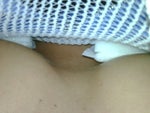 One breast more swollen after cat jumped on it
