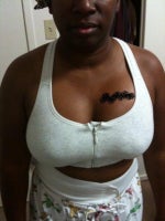 Left breast still high and swollen