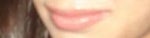Defining or plumping lips with Restylane and/or Juvederm