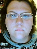 Can surgery correct asymmetry as far as eye shape and placement?