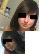 Eligible for rhinoplasty?