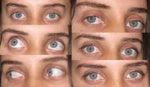 What are the options to change eye shape?