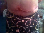 Another one Closer up. You can see where the hard parts are in my abdomen as they bulge