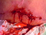 Just a closer view of worst area this week. 02/24/11