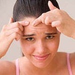 SebRx says Stop Oil, Stop Zits