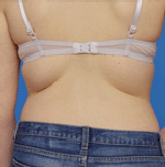Bra-llelujah keeps back fat hidden