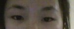 Asian eyes enlargement
