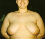 What type of breast do i have?