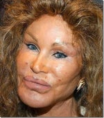 When Have You Gone Too Far? Plastic Surgery Creates "Lion Woman"