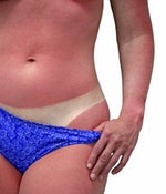 AfterBurn Gel cools...and repairs