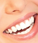 Get Whiter Teeth Fast