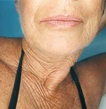 Study shows 3 ways to fight skin aging