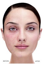 Hide blemishes & melasma: Dermablend Smooth Indulgence