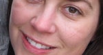 cheek dents cheek dents